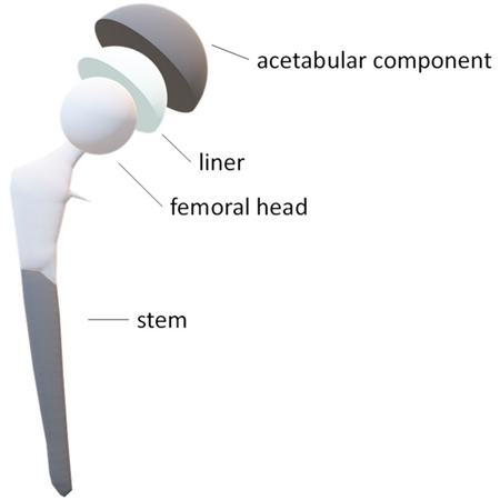 grinding the ceramic&stainless steel femoral head